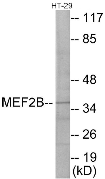 MEF2B Colorimetric Cell-Based ELISA (CBCAB01058)
