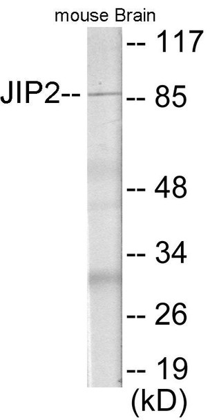 JIP2 Colorimetric Cell-Based ELISA (CBCAB01083)