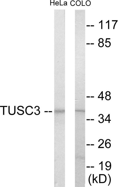 TUSC3 Colorimetric Cell-Based ELISA (CBCAB01085)