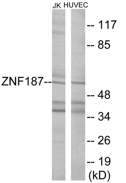 ZNF187 Colorimetric Cell-Based ELISA (CBCAB01122)