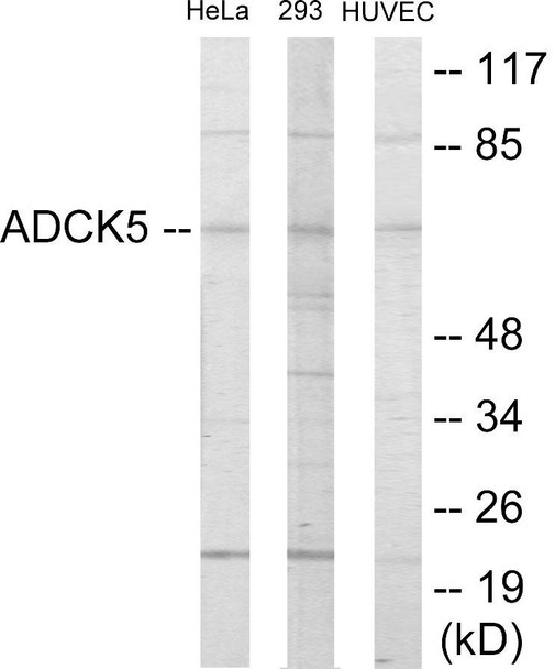 ADCK5 Colorimetric Cell-Based ELISA (CBCAB01127)