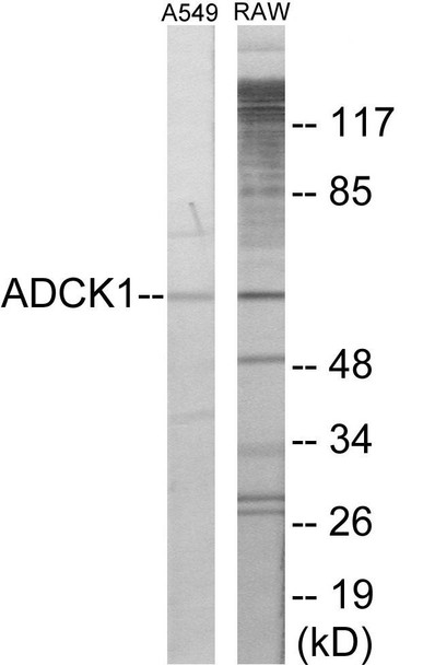 ADCK1 Colorimetric Cell-Based ELISA (CBCAB01145)