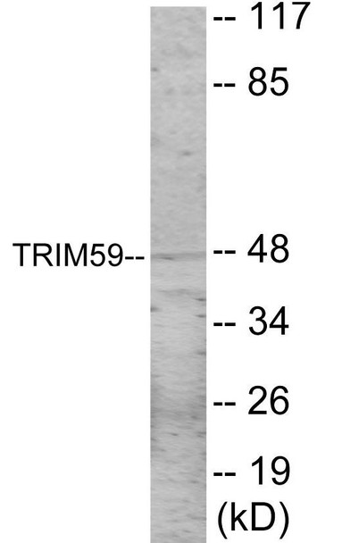 TRIM59 Colorimetric Cell-Based ELISA (CBCAB01149)