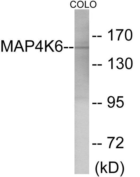 MAP4K6 Colorimetric Cell-Based ELISA (CBCAB01153)