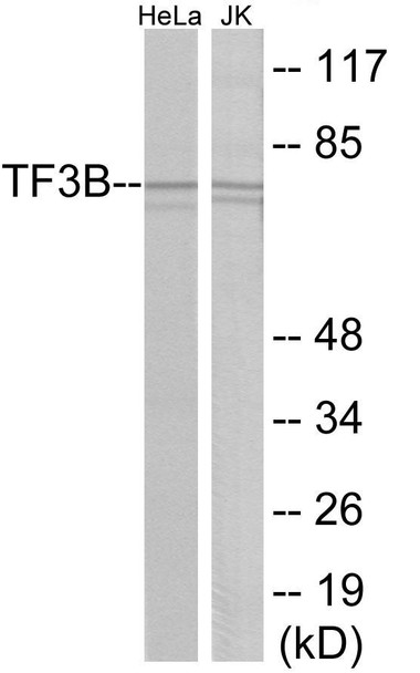 TF3B Colorimetric Cell-Based ELISA (CBCAB01174)