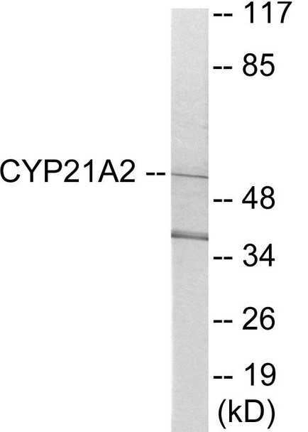 Cytochrome P450 21A2 Colorimetric Cell-Based ELISA (CBCAB01186)