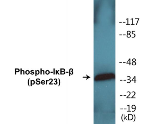 IkappaB-beta (Phospho-Ser23)Colorimetric Cell-Based ELISA Kit (CBCAB01216)