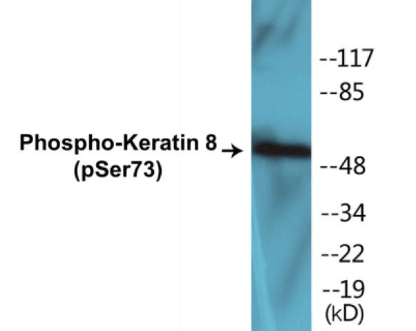 Keratin 8 (Phospho-Ser73)Colorimetric Cell-Based ELISA Kit (CBCAB01219)