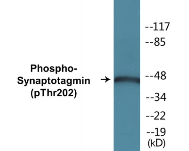 Synaptotagmin (Phospho-Thr202)Colorimetric Cell-Based ELISA Kit (CBCAB01226)