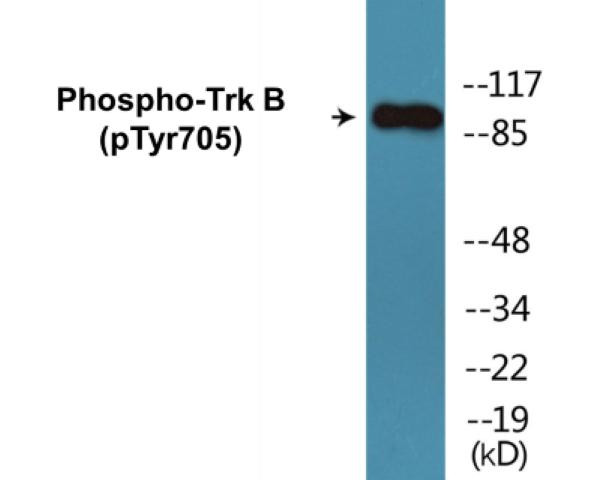 Trk B (Phospho-Tyr705)Colorimetric Cell-Based ELISA Kit (CBCAB01227)