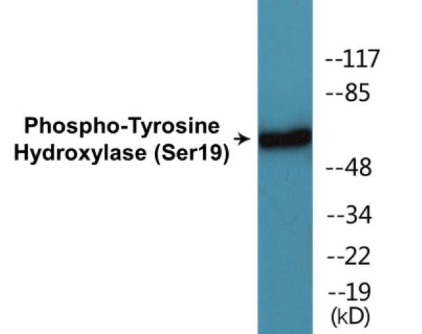 Tyrosine Hydroxylase (Phospho-Ser19)Colorimetric Cell-Based ELISA Kit (CBCAB01228)