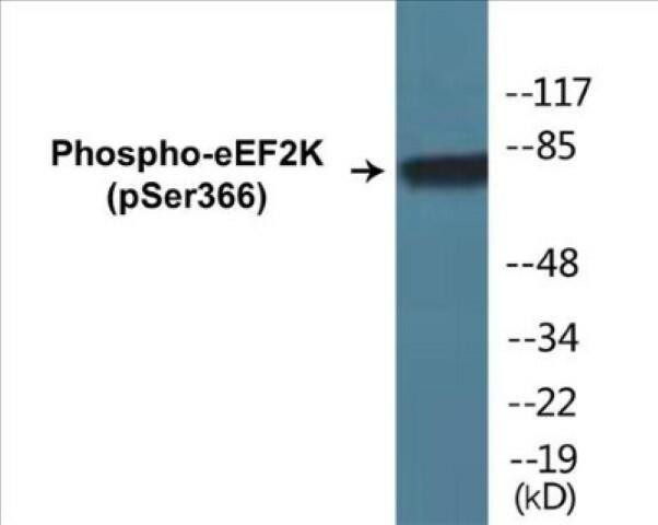 eEF2K (Phospho-Ser366)Colorimetric Cell-Based ELISA Kit (CBCAB01241)