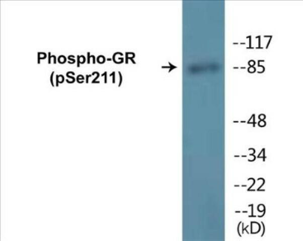 GR (Phospho-Ser211)Colorimetric Cell-Based ELISA Kit (CBCAB01242)