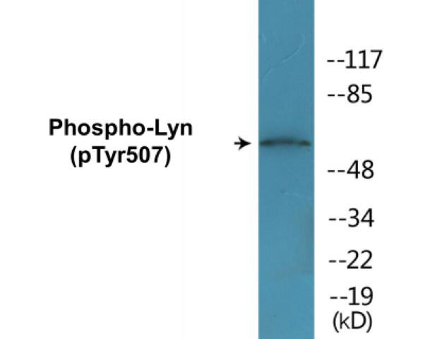 Lyn (Phospho-Tyr507)Colorimetric Cell-Based ELISA Kit (CBCAB01245)