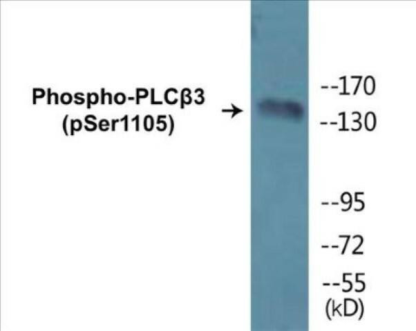 PLCbeta3 (Phospho-Ser1105)Colorimetric Cell-Based ELISA Kit (CBCAB01246)