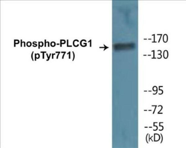 PLCG1 (Phospho-Tyr771)Colorimetric Cell-Based ELISA Kit (CBCAB01247)