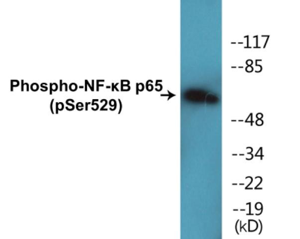 NF-kappaB p65 (Phospho-Ser529)Colorimetric Cell-Based ELISA Kit (CBCAB01257)