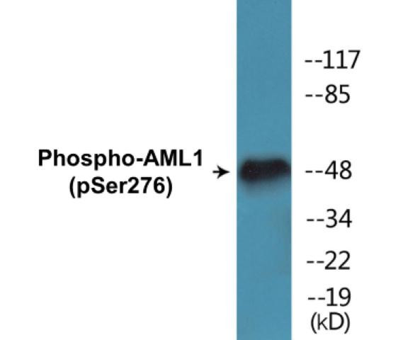 AML1 (Phospho-Ser276)Colorimetric Cell-Based ELISA Kit (CBCAB01261)