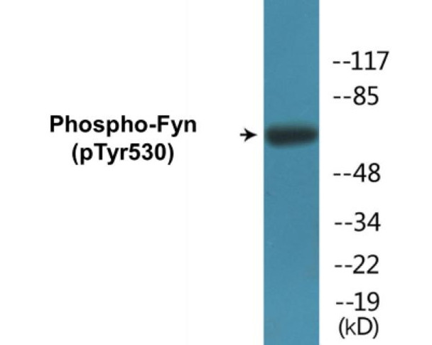 Fyn (Phospho-Tyr530)Colorimetric Cell-Based ELISA Kit (CBCAB01271)