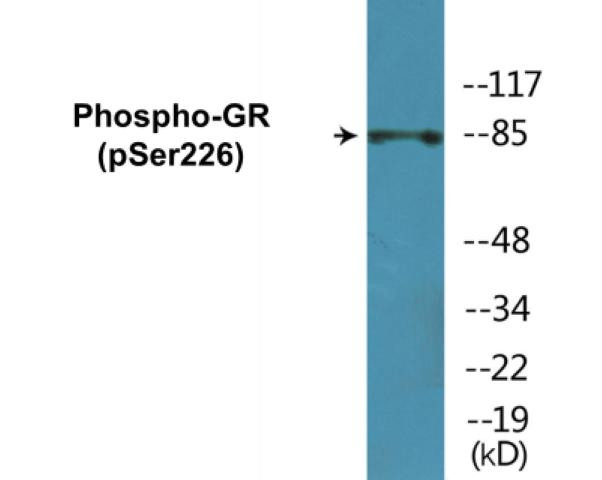 GR (Phospho-Ser226)Colorimetric Cell-Based ELISA Kit (CBCAB01272)