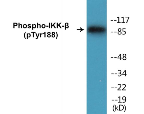 IKK-beta (Phospho-Tyr188)Colorimetric Cell-Based ELISA Kit (CBCAB01276)
