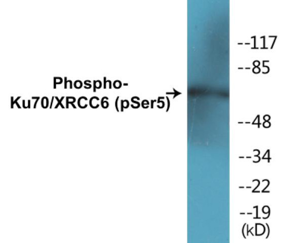 Ku70/XRCC6 (Phospho-Ser5)Colorimetric Cell-Based ELISA Kit (CBCAB01280)