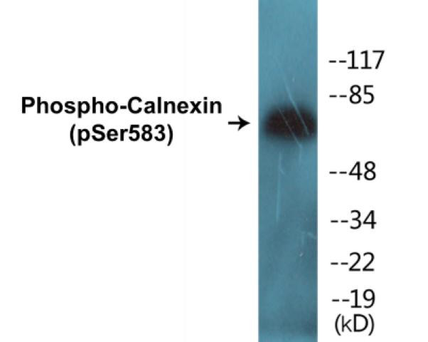 Calnexin (Phospho-Ser583)Colorimetric Cell-Based ELISA Kit (CBCAB01285)
