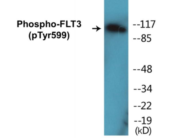 FLT3 (Phospho-Tyr599)Colorimetric Cell-Based ELISA Kit (CBCAB01291)