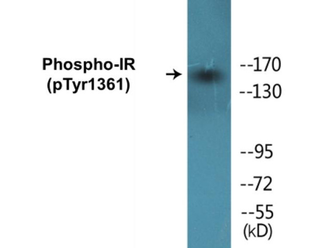 IR (Phospho-Tyr1361)Colorimetric Cell-Based ELISA Kit (CBCAB01295)