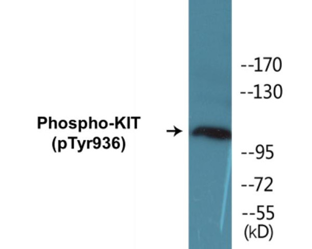KIT (Phospho-Tyr936)Colorimetric Cell-Based ELISA Kit (CBCAB01297)