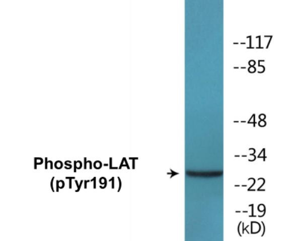 LAT (Phospho-Tyr191)Colorimetric Cell-Based ELISA Kit (CBCAB01299)