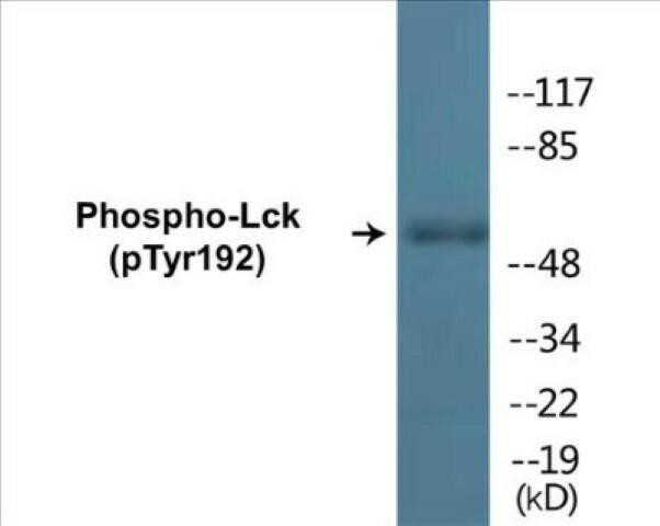 Lck (Phospho-Tyr192)Colorimetric Cell-Based ELISA Kit (CBCAB01300)