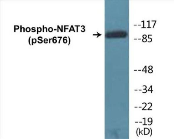 NFAT3 (Phospho-Ser676)Colorimetric Cell-Based ELISA Kit (CBCAB01303)