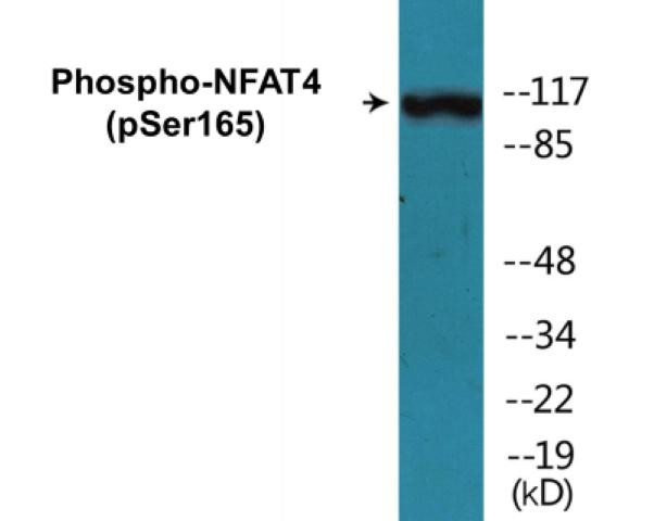 NFAT4 (Phospho-Ser165)Colorimetric Cell-Based ELISA Kit (CBCAB01304)