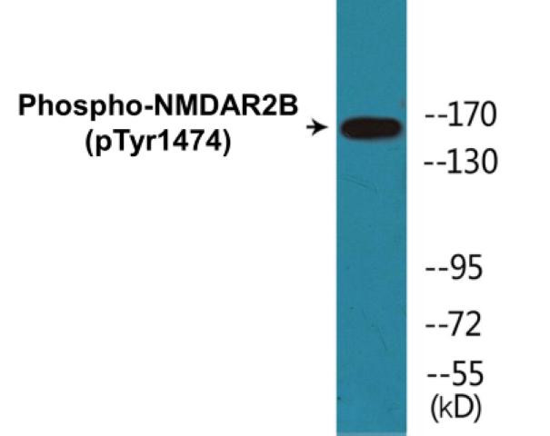 NMDAR2B (Phospho-Tyr1474)Colorimetric Cell-Based ELISA Kit (CBCAB01305)