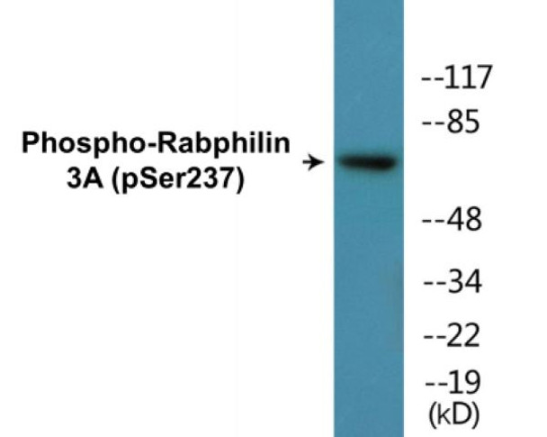 Rabphilin 3A (Phospho-Ser237)Colorimetric Cell-Based ELISA Kit (CBCAB01314)
