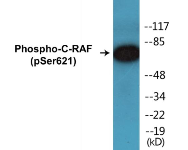 C-RAF (Phospho-Ser621)Colorimetric Cell-Based ELISA Kit (CBCAB01316)