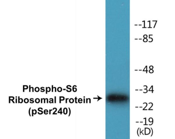S6 Ribosomal Protein (Phospho-Ser240)Colorimetric Cell-Based ELISA Kit (CBCAB01317)