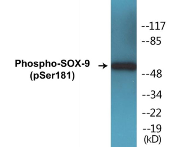 SOX-9 (Phospho-Ser181)Colorimetric Cell-Based ELISA Kit (CBCAB01319)