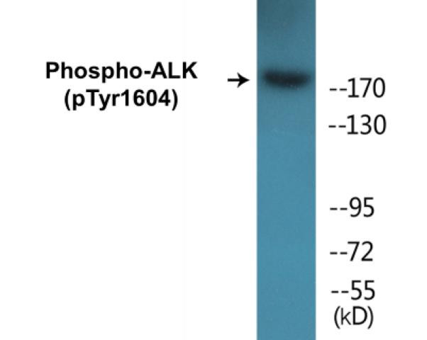 ALK (Phospho-Tyr1604)Colorimetric Cell-Based ELISA Kit (CBCAB01337)