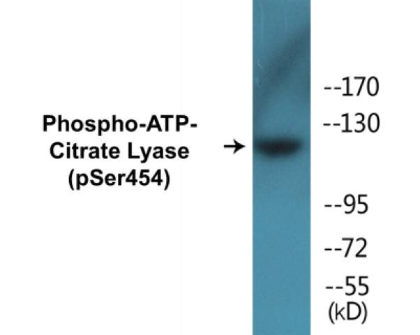 ATP-Citrate Lyase (Phospho-Ser454)Colorimetric Cell-Based ELISA Kit (CBCAB01338)
