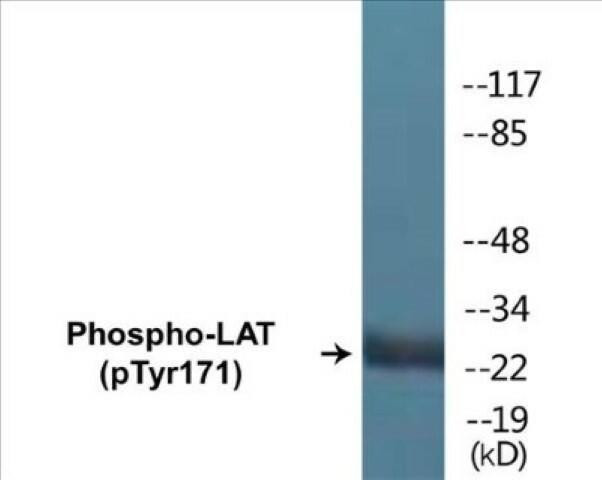 LAT (Phospho-Tyr171)Colorimetric Cell-Based ELISA Kit (CBCAB01342)