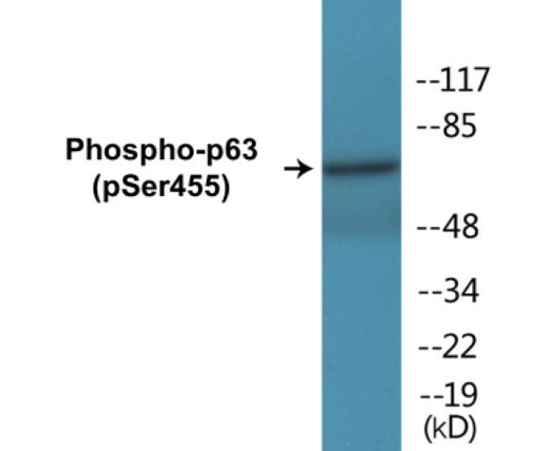 p63 (Phospho-Ser455)Colorimetric Cell-Based ELISA Kit (CBCAB01351)