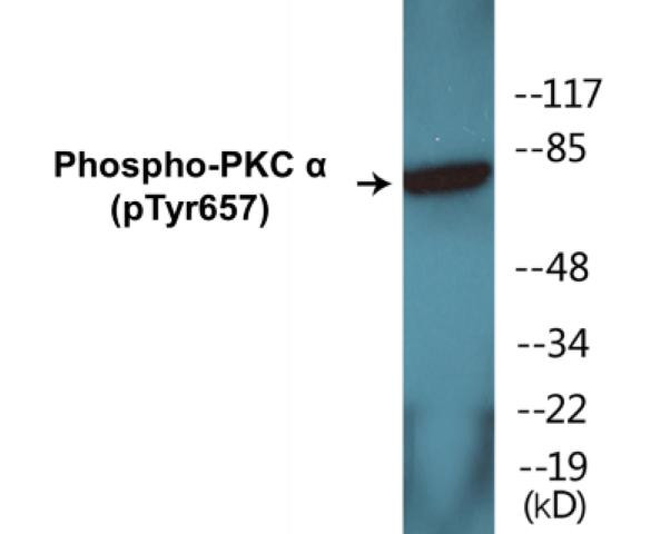 PKC alpha (Phospho-Tyr657)Colorimetric Cell-Based ELISA Kit (CBCAB01374)