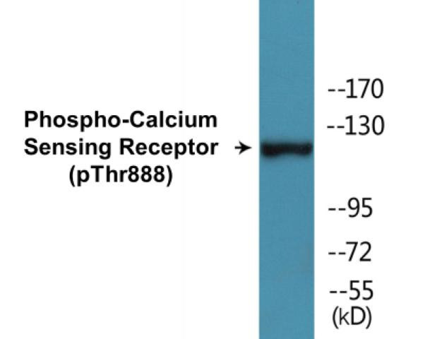 Calcium Sensing Receptor (Phospho-Thr888)Colorimetric Cell-Based ELISA Kit (CBCAB01392)