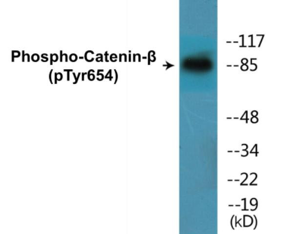 Catenin-beta (Phospho-Tyr654)Colorimetric Cell-Based ELISA Kit (CBCAB01399)