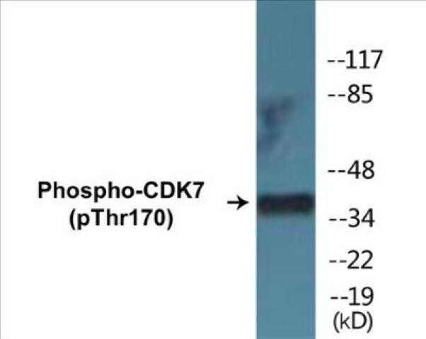 CDK7 (Phospho-Thr170)Colorimetric Cell-Based ELISA Kit (CBCAB01403)