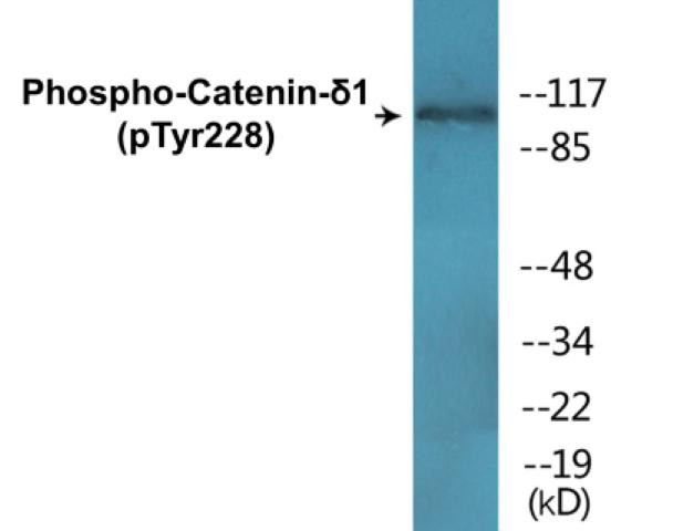 Catenin-delta1 (Phospho-Tyr228)Colorimetric Cell-Based ELISA Kit (CBCAB01410)