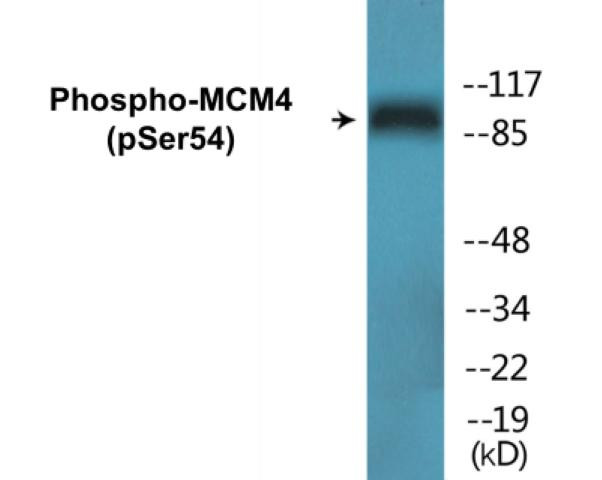 MCM4 (Phospho-Ser54)Colorimetric Cell-Based ELISA Kit (CBCAB01417)