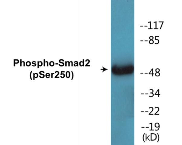 Smad2 (Phospho-Ser250)Colorimetric Cell-Based ELISA Kit (CBCAB01437)